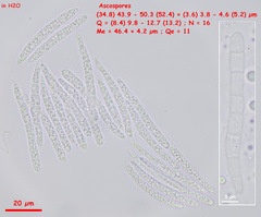Strossmayeria basitricha