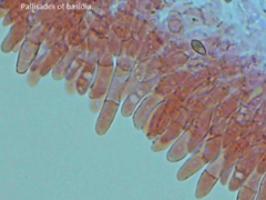 Rhopalogaster transversarius