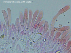 Rhopalogaster transversarius