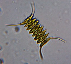 Desmodesmus protuberans