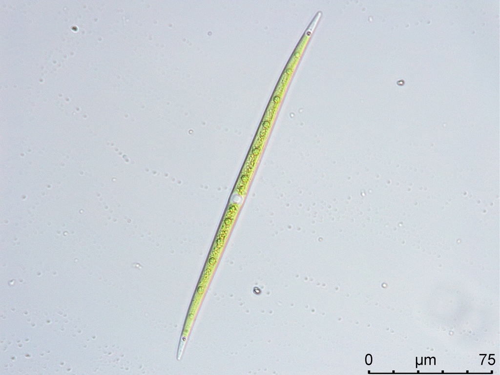 Closterium limneticum