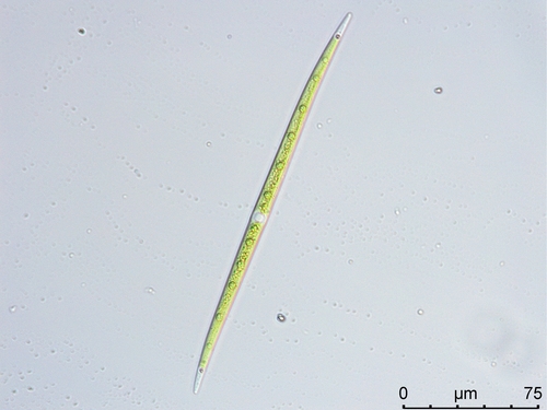 Closterium limneticum