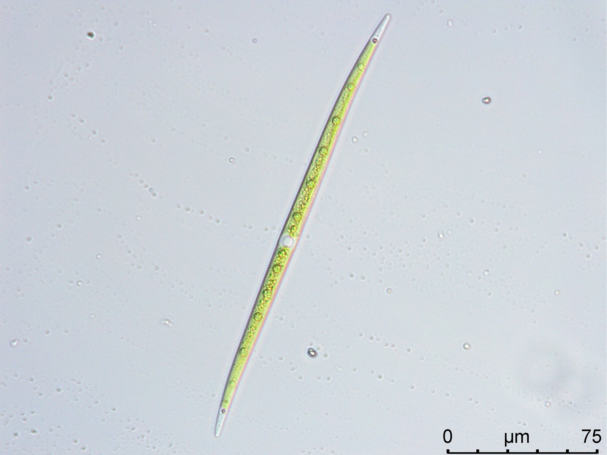 Closterium limneticum