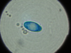 Xylographa rubescens