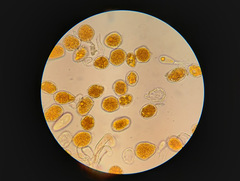 Phragmidium bulbosum