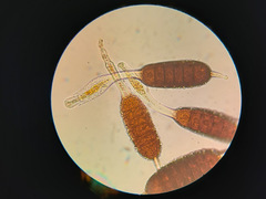 Phragmidium bulbosum