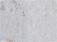 Hymenoscyphus immutabilis