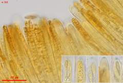 Hymenoscyphus immutabilis