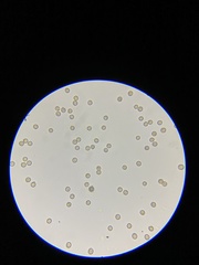 Crepidotus stipitatus