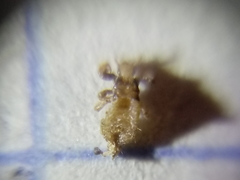 Pediculus humanus