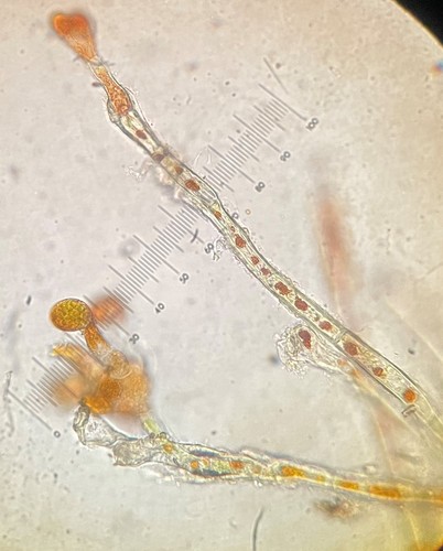 Image of Cephaleuros virescens by (c) Henry Van T. Cotter, some rights reserved (CC BY)