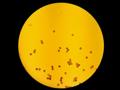 Uromyces trifolii-repentis