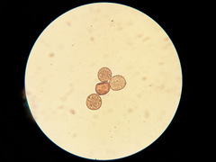 Uromyces trifolii-repentis