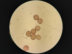 Uromyces trifolii-repentis