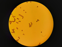 Uromyces trifolii-repentis