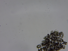 Dolichospermum lemmermannii