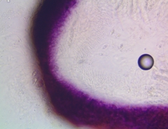 Corinectria fuckeliana