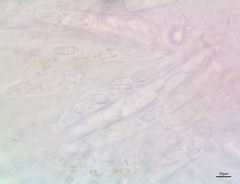 Melanconis stilbostoma