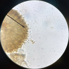Nesolechia oxyspora