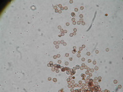 Clastoderma debaryanum