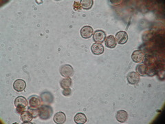 Clastoderma debaryanum