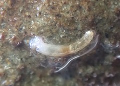 Caecum