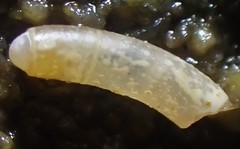Caecum