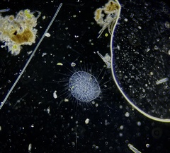 Actinosphaerium