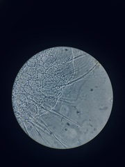 Actinosphaerium