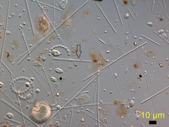 Anabaena inaequalis