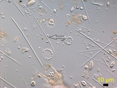 Aphanizomenon issatschenkoi