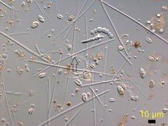 Aphanizomenon flosaquae