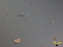 Dinobryon cylindricum