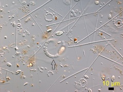 Dolichospermum crassum