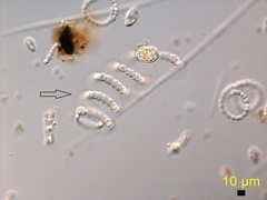 Dolichospermum crassum