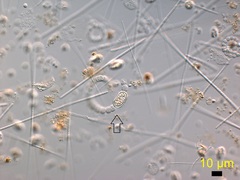 Dolichospermum crassum