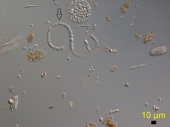 Dolichospermum flosaquae