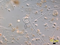 Dolichospermum flosaquae