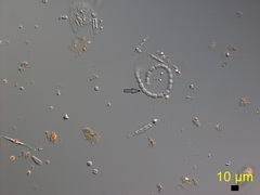 Dolichospermum flosaquae