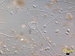 Dolichospermum flosaquae