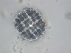 Gomphosphaeria