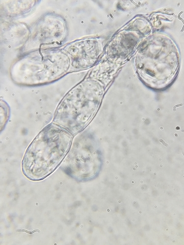 Podosphaera erigerontis-canadensis