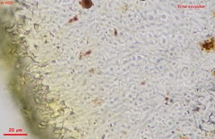 Calycina scolochloae