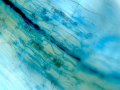Glomeromycota