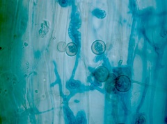 Glomeromycota
