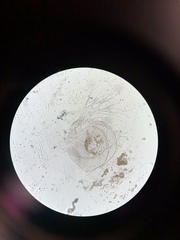 Simocephalus