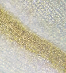 Vinealobryum nicholsonii