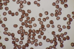 Sphacelotheca hydropiperis