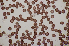 Sphacelotheca hydropiperis