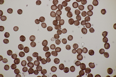 Sphacelotheca hydropiperis